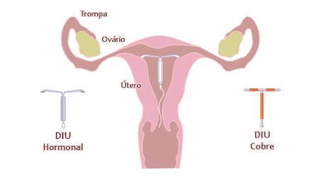 Menstruação, o que é? – Dra Claudiani Alves Branco Gregorin