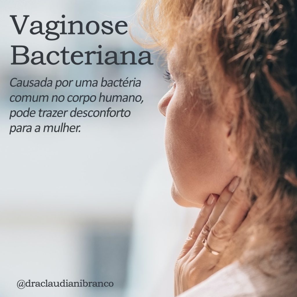 Dra Claudiani Branco explica a Vaginose bacteriana. Foto: Adam Niescioruk no Unsplash.