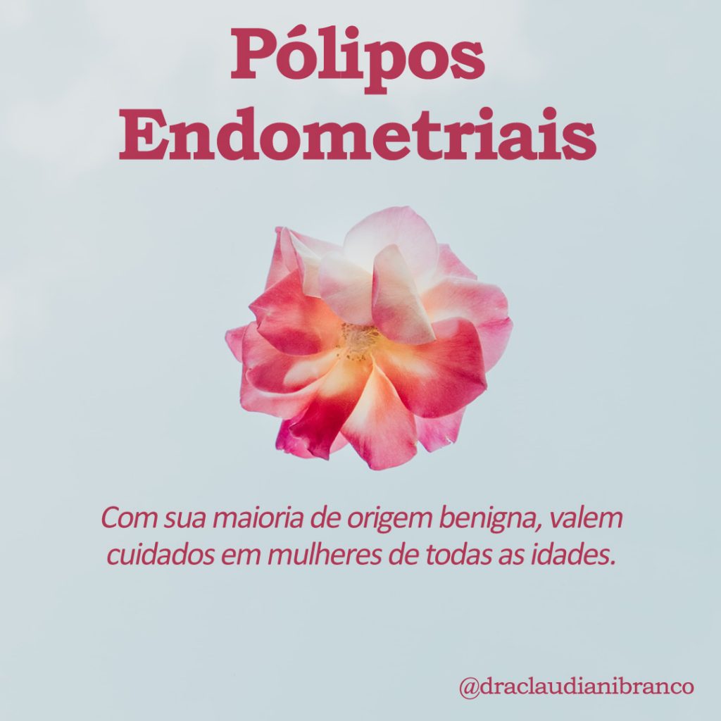 Dra Claudiani Branco Ginecologista fala sobre os pólipos endometriais. Imagem: Evie S no Unsplash.