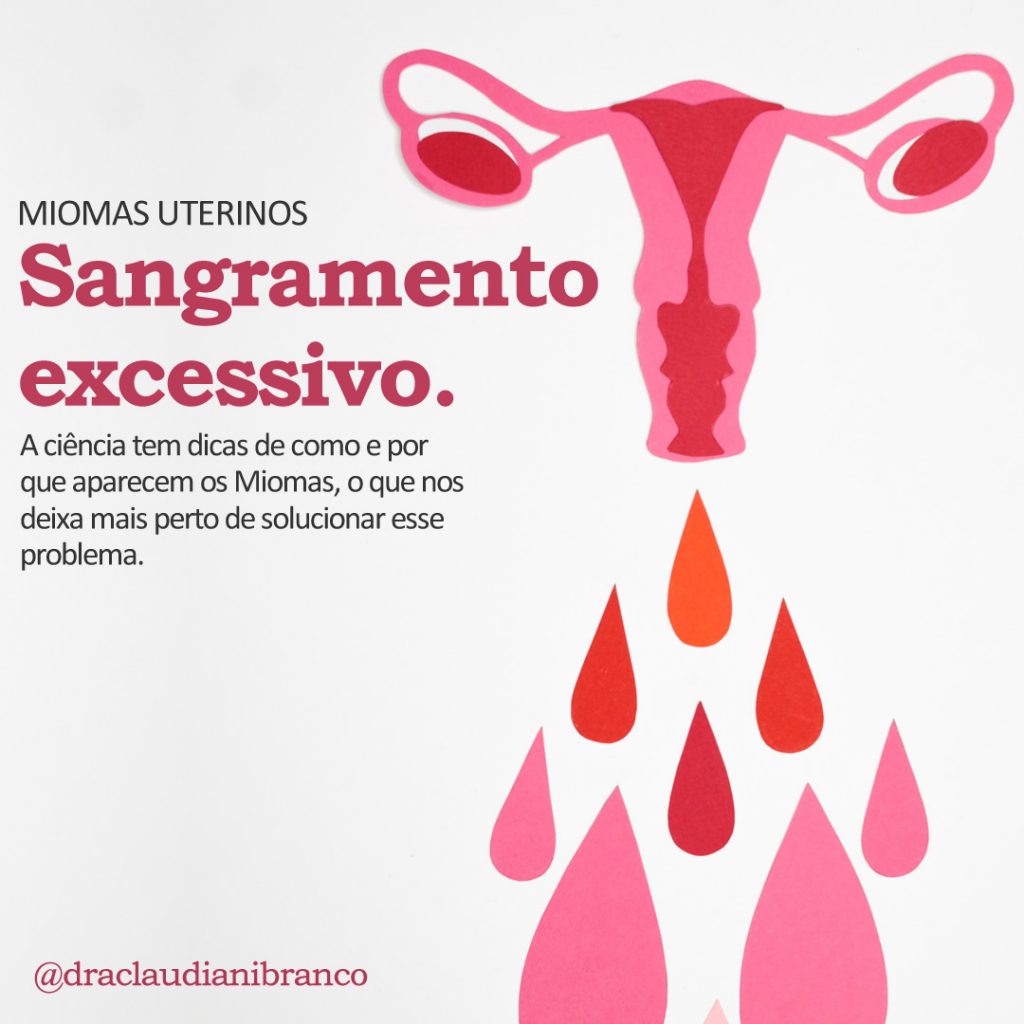 Dra Claudiani Branco Ginecologista fala sobre o sangramento excessivo causado pelo mioma uterino. Imagem: Nadezhda Morya no Pexels.