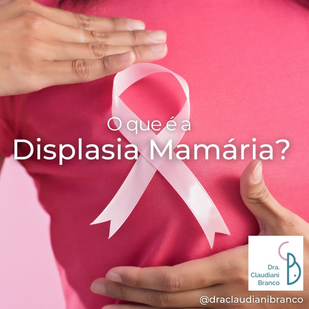 Ginecologista Dra Claudiani Branco fala sobre a Displasia Mamária no Outubro Rosa, mês de combate ao Câncer de Mama.