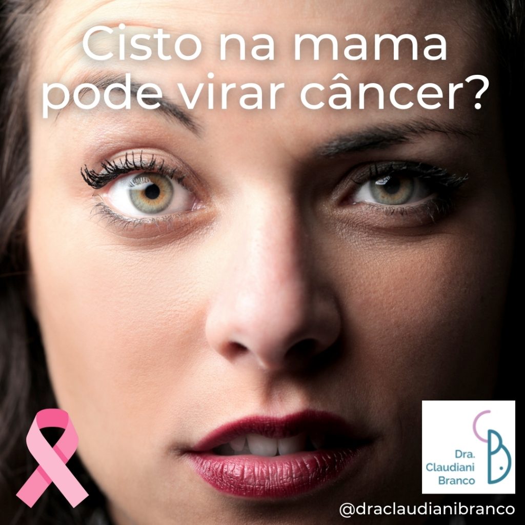 Ginecologista Dra Claudiani Branco esclarece a dúvida sobre cisto na mama e câncer de mama no OUtubro Rosa.