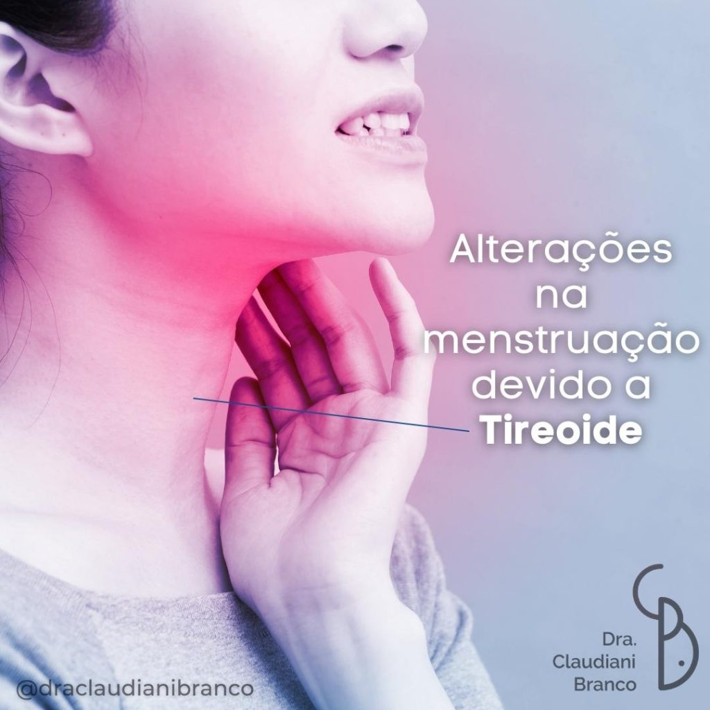 Dra Claudiani Branco Ginecologista e Obstetra explica alterações na menstruação devido a tireoide.