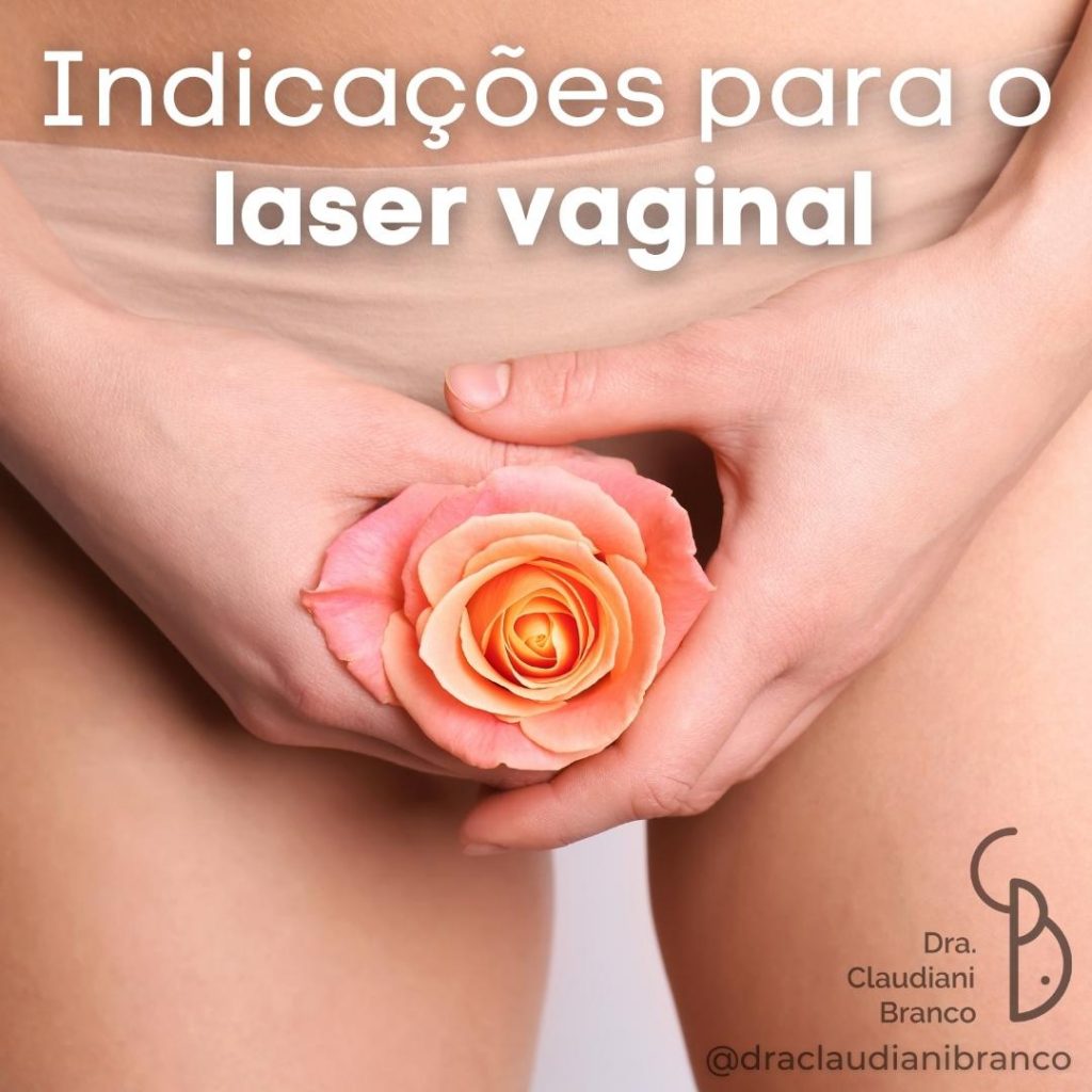 Indicações para o laser vaginal Dra Claudiani Alves Branco Gregorin