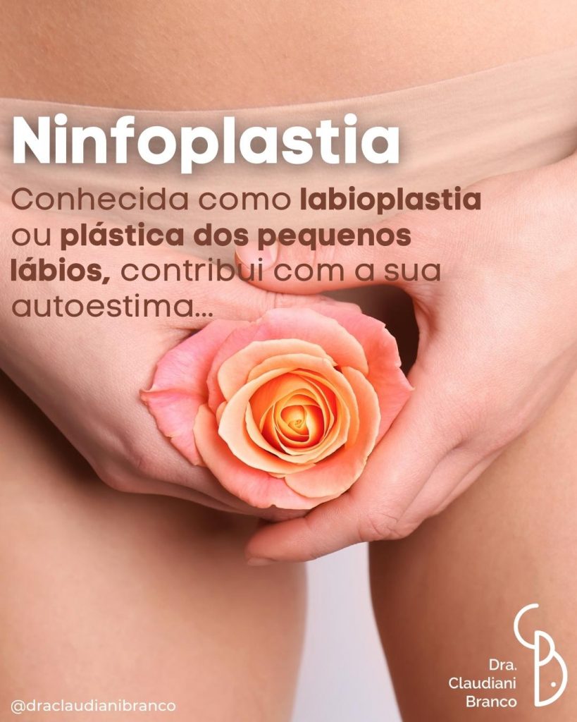 Médica Ginecologista e Obstetra Dra Claudiani Branco explica a ninfoplastia.